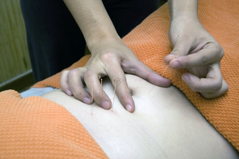 osteopathe-LA VERDIERE-min_acupuncture-4175625